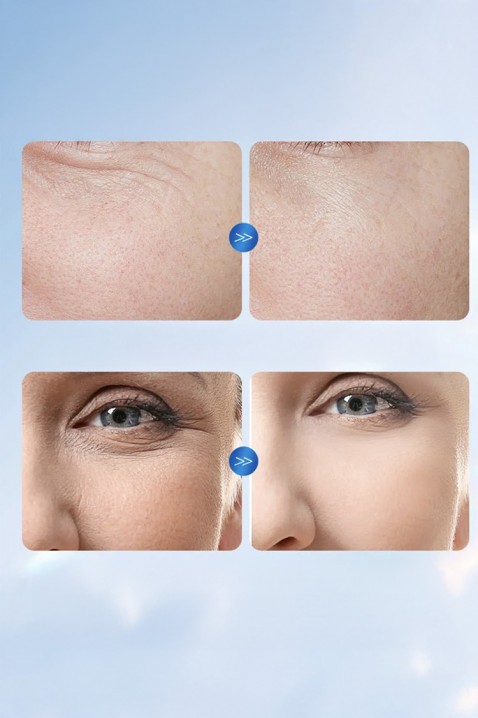 Ампули за лице SADOER Hyaluronic AcidIVET.BG - Твоят онлайн бутик.